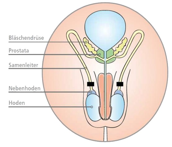 Vasektomie Illustration